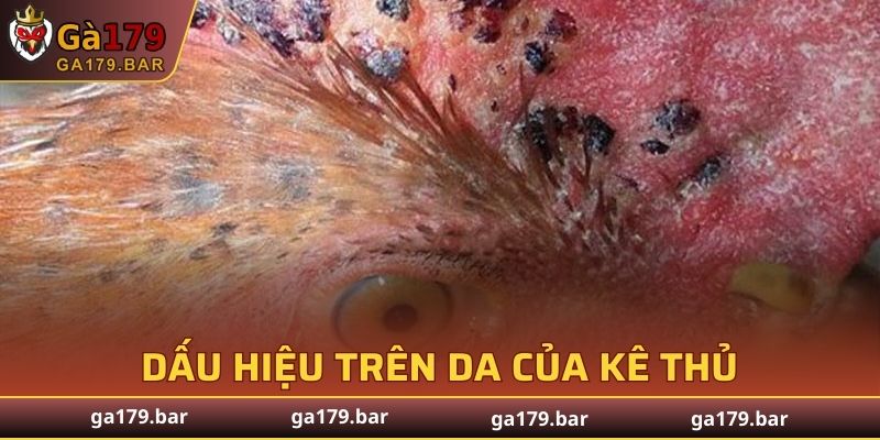 Dấu hiệu trên da của kê thủ